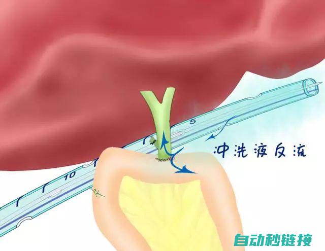 教你轻松搞定网线在线传输上传程序至S7300 (教你轻松搞定班级常规难题心得)